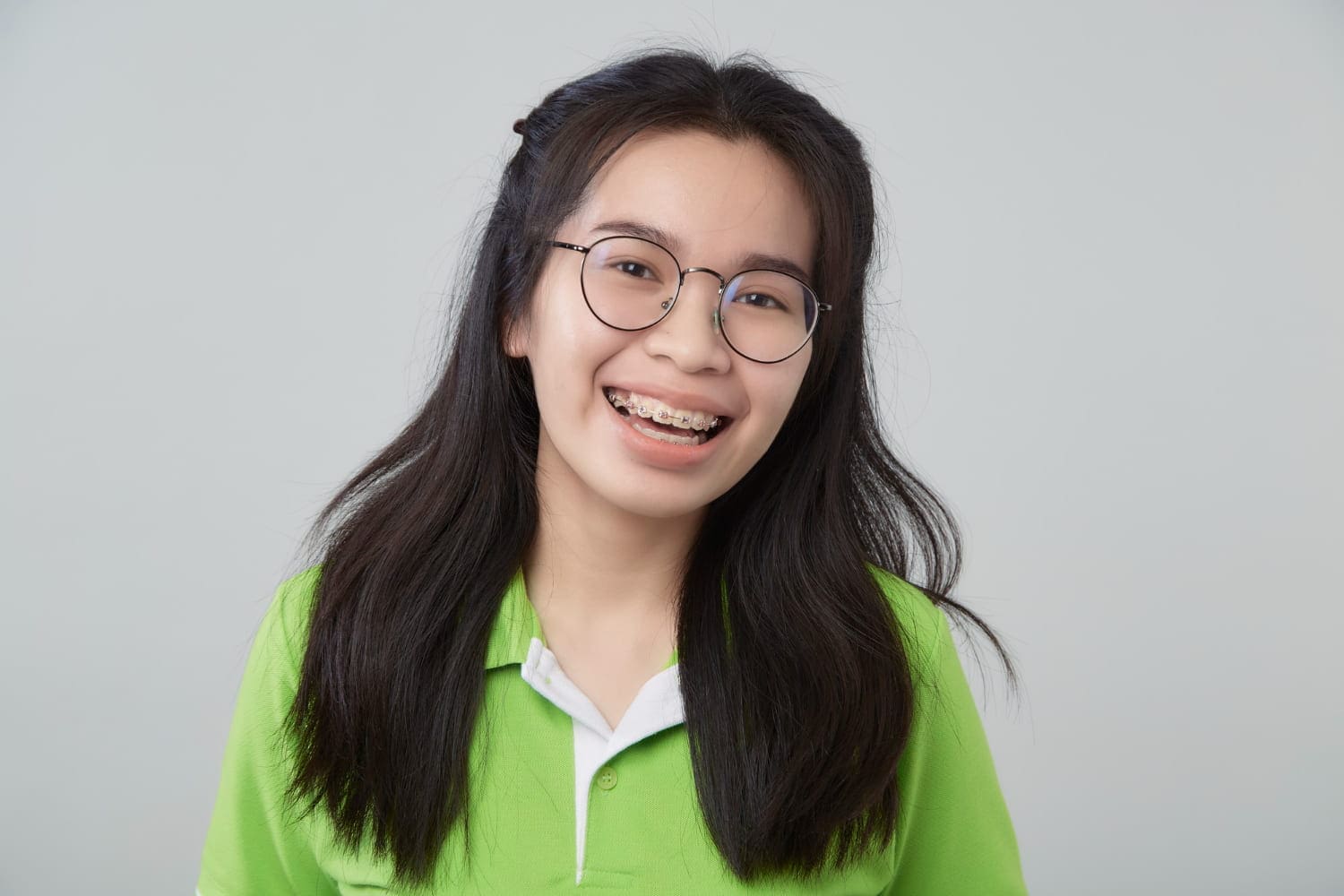 Smiling young woman with long dark hair, glasses, and metal braces, representing Carpinello Orthodontics in Drexel Hill, Newtown Square or Edgmont, PA.