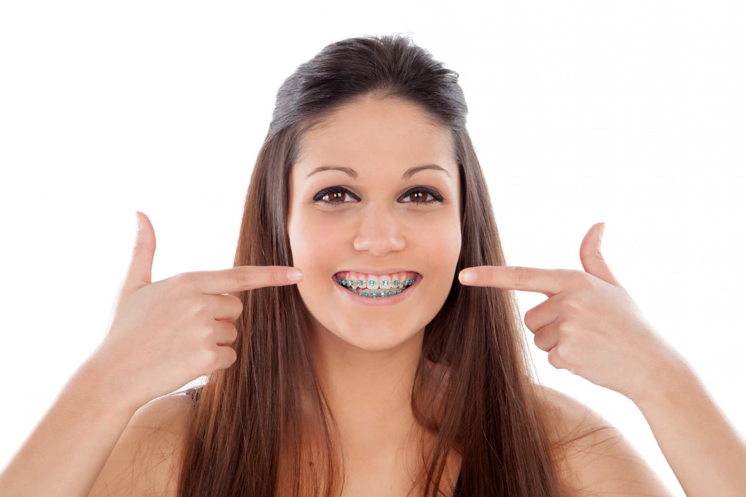 Smiling woman points to her clear braces, promoting Carpinello Orthodontics in Drexel Hill, Newtown Square or Edgmont, PA.