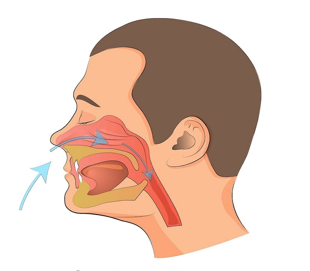 A diagram at Carpinello Orthodontics in Drexel Hill, Newtown Square or Edgmont, PA shows airflow in a head, focusing on mouth breathing.