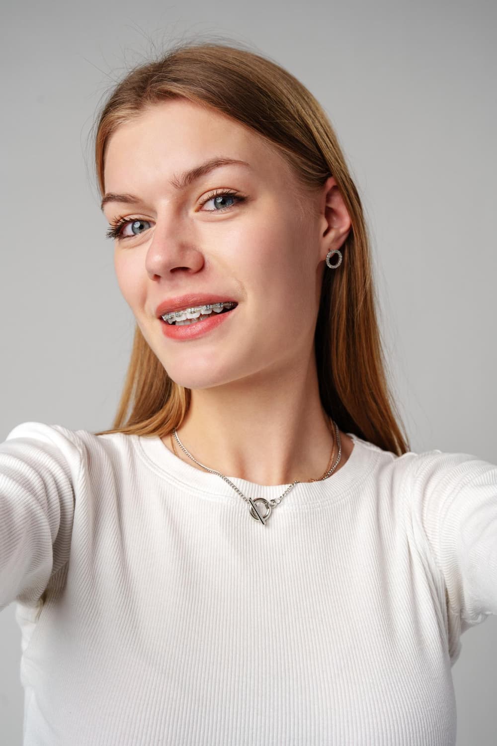 A young woman with braces smiles confidently after underbite treatment by Carpinello Orthodontics in Drexel Hill, Newtown Square or Edgmont, PA.