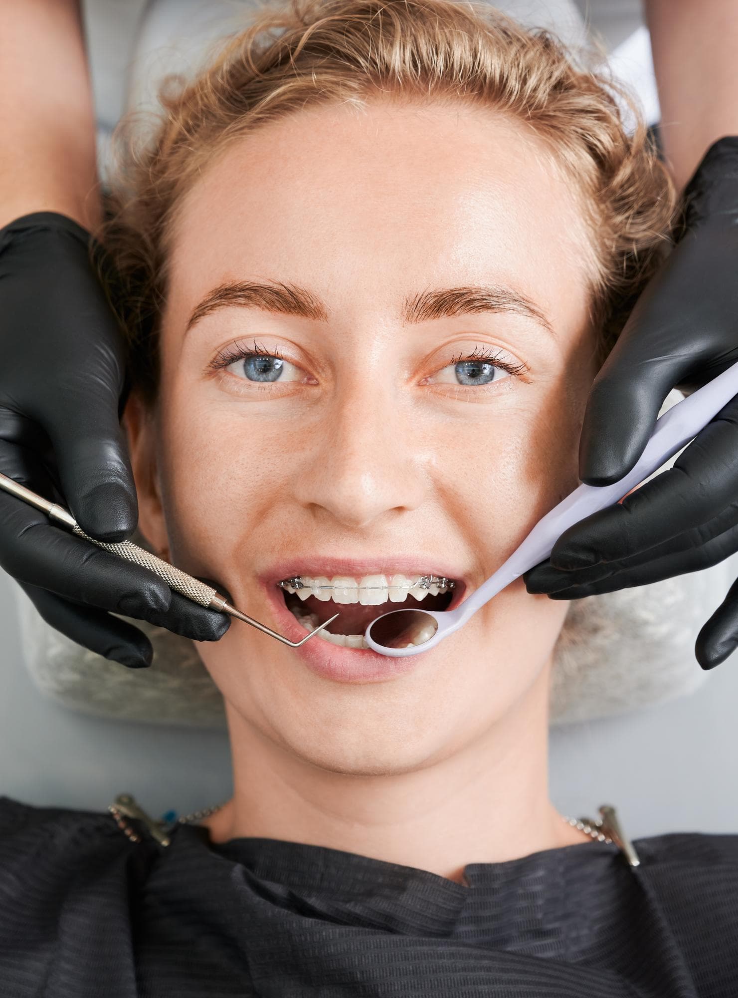 A dentist at Carpinello Orthodontics in Drexel Hill, Newtown Square or Edgmont, PA checks braces and discusses overbite treatment.