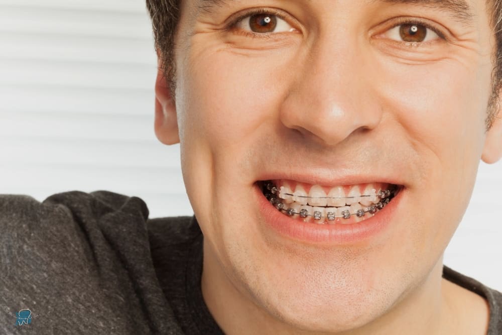 happy young man with metal braces - Overbite vs Underbite in Drexel Hill, Newtown Square, and Edgmont, PA