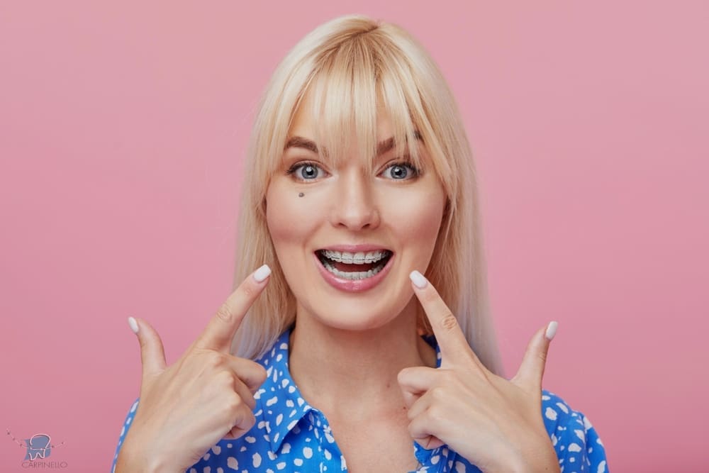 cheerful happy young woman blonde hair gesturing thumb while pointing clear braces - How To Get Braces Glue Off Teeth in Drexel Hill, Newtown Square and Edgmont, PA